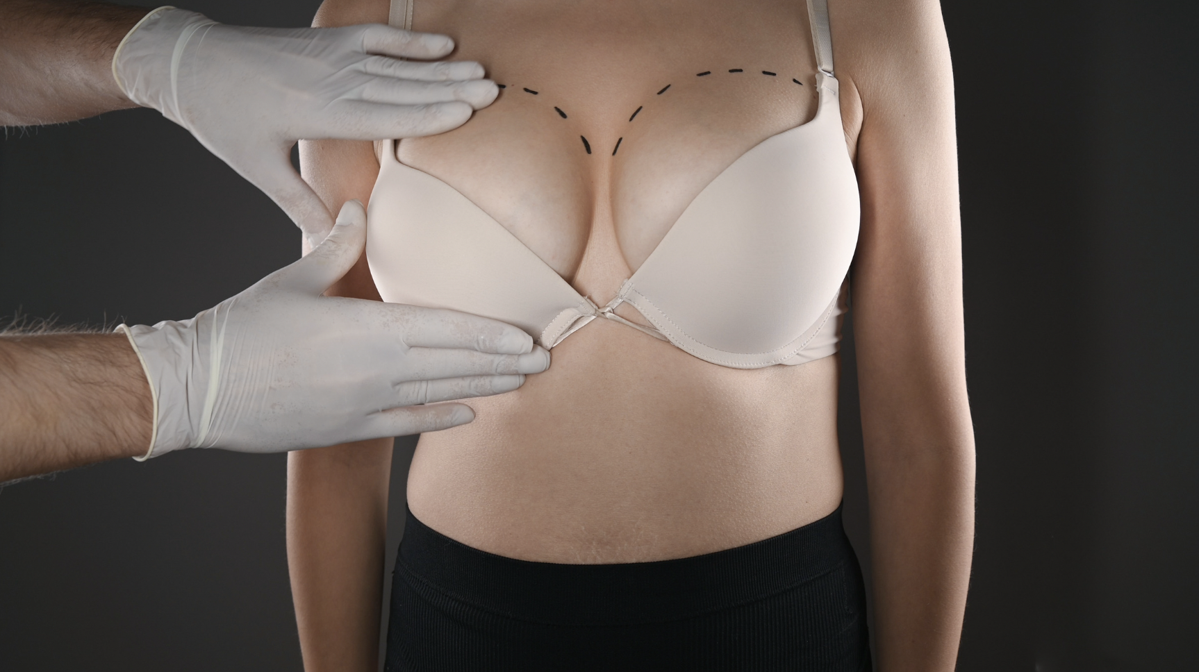 Breast Augmentation Recovery Day By Day in NYC