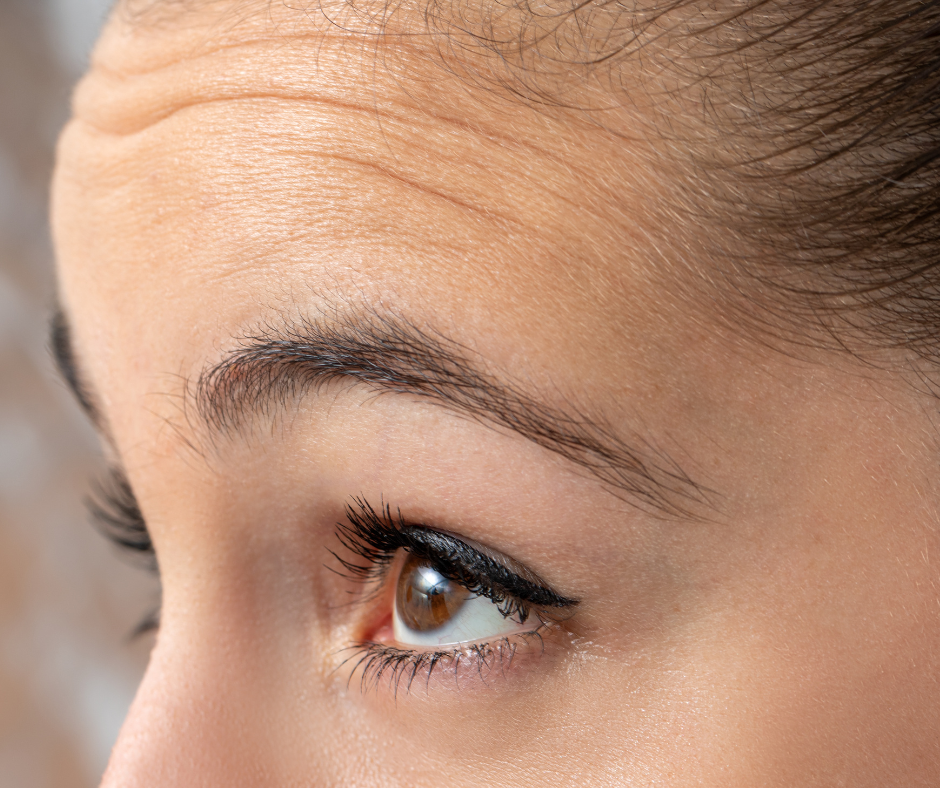 dermatology and surgery associates forehead wrinkles bronx ny